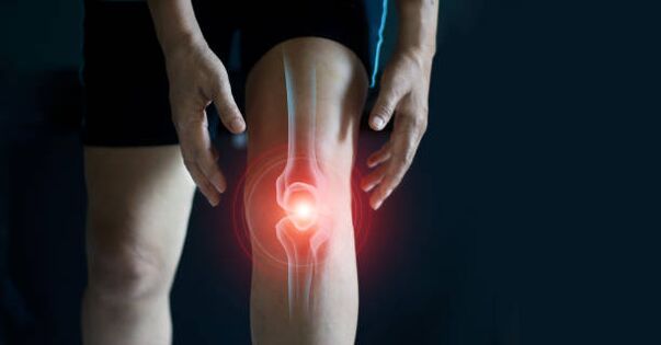 Knee wrist arthrosis