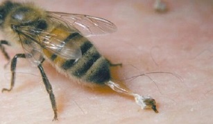 treatment of hip osteoarthritis in bees
